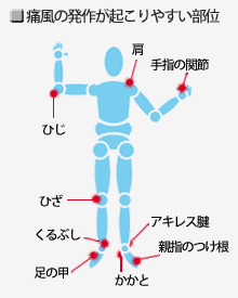 �ɕ��̋N����₷������